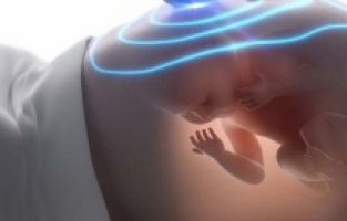 Hamilelik döneminde diş röntgeni tehlikeli mi?