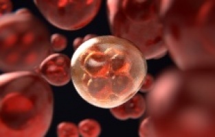 4 Kişiden 1’i kanser nedeniyle hayatını kaybediyor