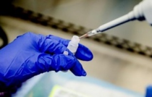 Koronavirüs en çok hangi kan grubuna bulaşıyor!